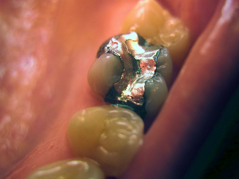 Mercury in the Mouth