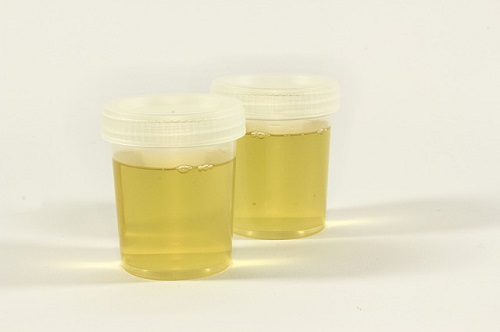 What does urine organic acids test for