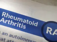 Similarities Between Lupus and Rheumatoid Arthritis (RA)