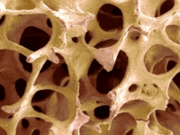 Similarities Between Compact and Spongy Bone